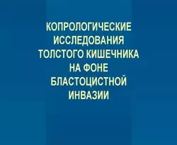 На сайте xtreker.ru вы можете прочитать книгу Копрологические исследования толстого кишечника на фоне бластоцистной инвазии под авторством Н. В. Бугеро, Н. И. Потатуркина-Нестерова, Н. А. Ильина бесплатно и без регистрации. Скачать книгу в формате FB2, TXT, RTF, EPUB. 9315733. На сайте xtreker.ru вы можете прочитать книгу Копрологические исследования толстого кишечника на фоне бластоцистной инвазии под авторством Н. В. Бугеро, Н. И. Потатуркина-Нестерова, Н. А. Ильина бесплатно и без регистрации. Скачать книгу в формате FB2, TXT, RTF, EPUB фото. На сайте xtreker.ru вы можете прочитать книгу Копрологические исследования толстого кишечника на фоне бластоцистной инвазии под авторством Н. В. Бугеро, Н. И. Потатуркина-Нестерова, Н. А. Ильина бесплатно и без регистрации. Скачать книгу в формате FB2, TXT, RTF, EPUB-9315733. картинка На сайте xtreker.ru вы можете прочитать книгу Копрологические исследования толстого кишечника на фоне бластоцистной инвазии под авторством Н. В. Бугеро, Н. И. Потатуркина-Нестерова, Н. А. Ильина бесплатно и без регистрации. Скачать книгу в формате FB2, TXT, RTF, EPUB. картинка 9315733. В книге представлены материалы, отражающие современные представления о роли простейших Blastocystis spp. в патологии желудочно-кишечного тракта человека. Монография содержит сведения о функциональном состоянии толстого кишечника при инвазии бластоцистами. Впервые приведены результаты изучения толстой кишки по данным копрологических исследований. Особое внимание уделено вопросам направленности химических процессов в кишечнике при бластоцистной инвазии. Достоинством монографии является экспериментальное подтверждение роли Blastocystis spp. в нарушении функционального состояния толстого кишечника человека по данным копрологических исследований и произведена его оценка для диагностики паразитарных инфекций. Монография является обобщением новейших материалов литературы и результатов собственных исследований.